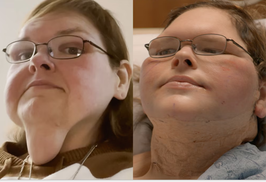 Does anyone know what surgery Amanda had this time?