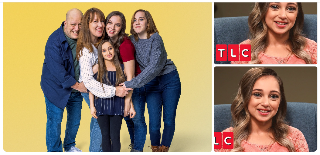“The Science Behind Shauna Rae’s Condition — And the Courage Behind Her Smile”