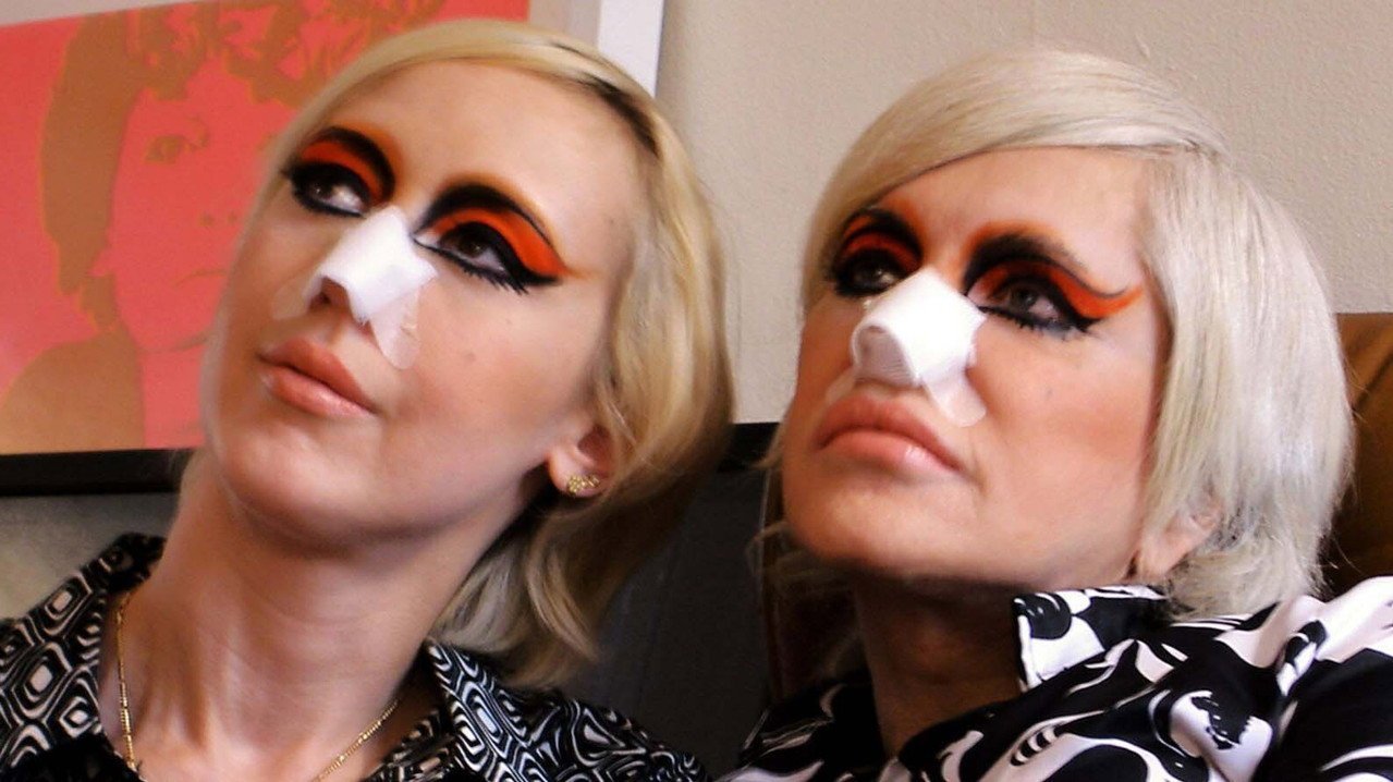 Darcey and Stacey Silva in the film White T with nose bandages